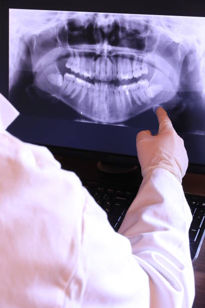 Best Emergency Dentist for Knocked-Out Tooth in Vermilion, OH
